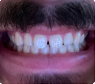 I love my new smile!