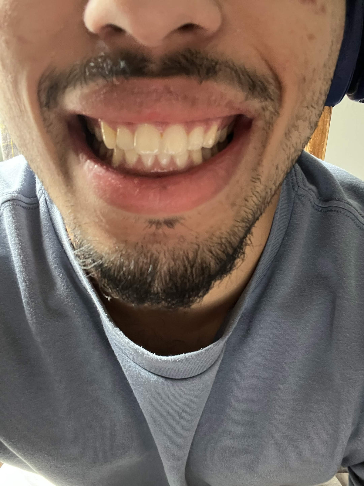 After treatment
