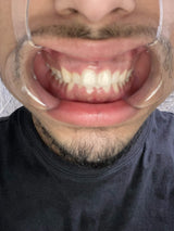 World-class experience from Caspersmile!