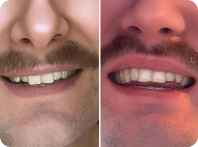 Caspersmile - Crowding