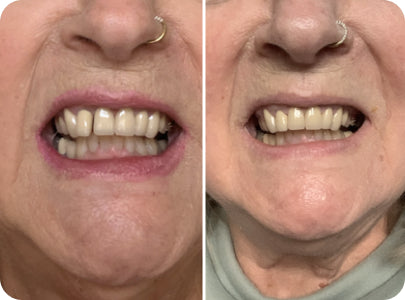 Caspersmile - Spacing