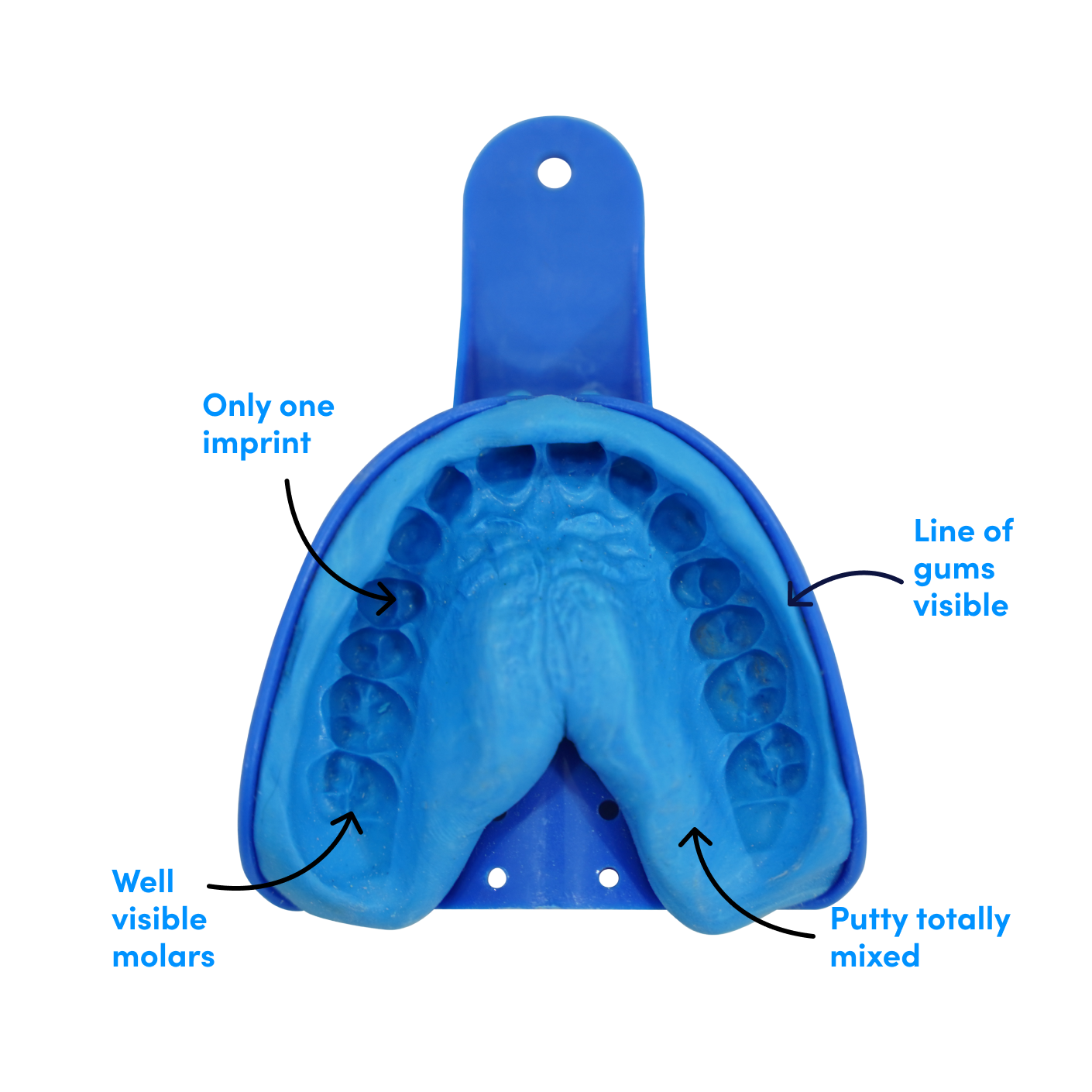 How to take impression – Caspersmile