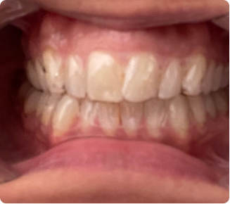The results are amazing!