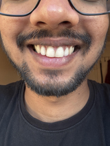 Really happy with the results!