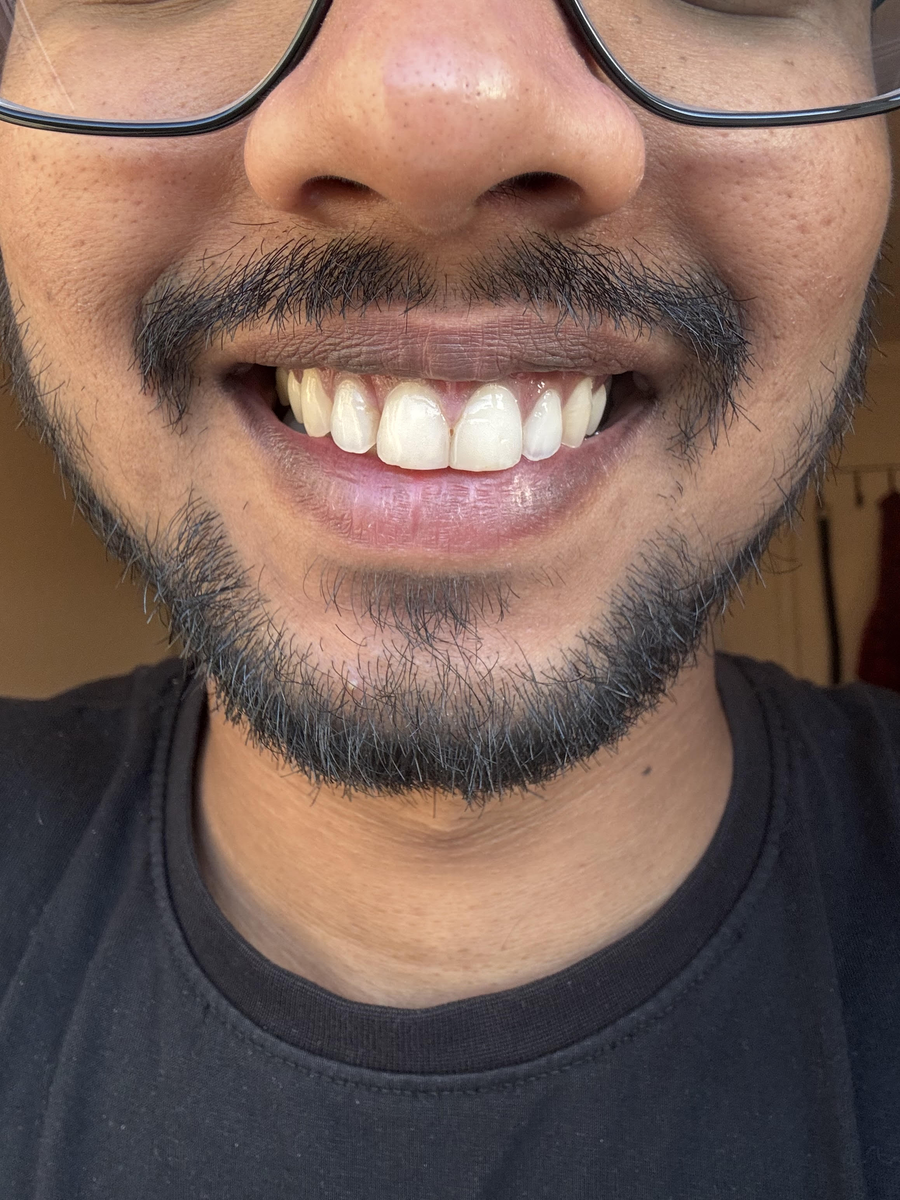 Really happy with the results!