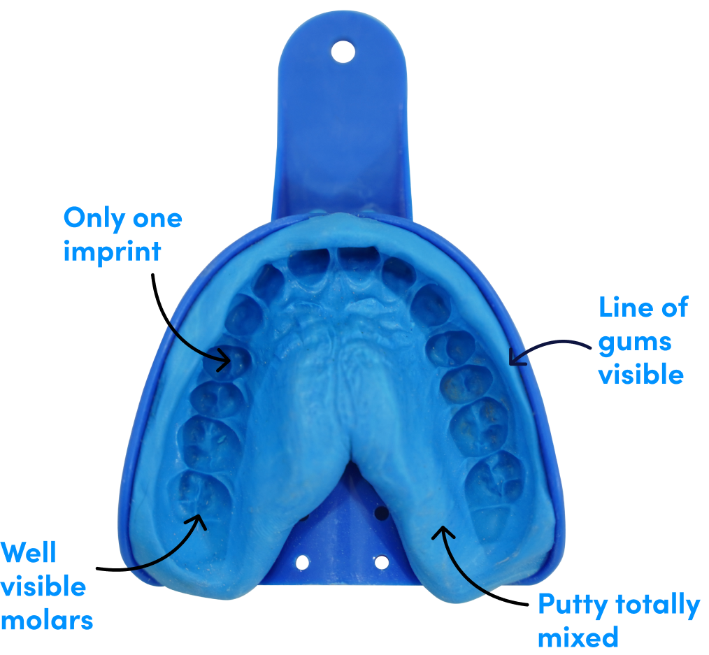 General Impression Step How to take impression β Caspersmile