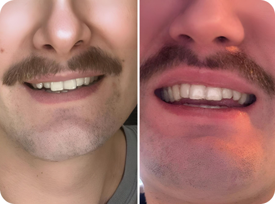 Caspersmile - Crowding