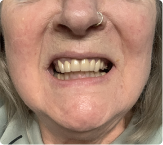 Thrilled with the results!