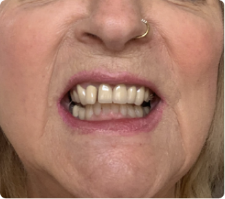 Thrilled with the results!