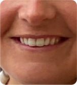 Before treatment